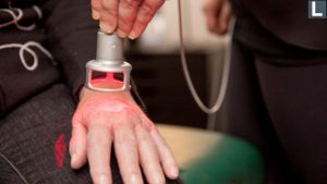 effectiveness-of-laser-therapy